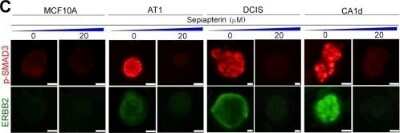 Immunocytochemistry/ Immunofluorescence: Smad3 [p Ser423, p Ser425] Antibody [NBP1-77836]